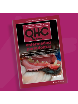 Qué Hacer Con... Enfermedad periodontal