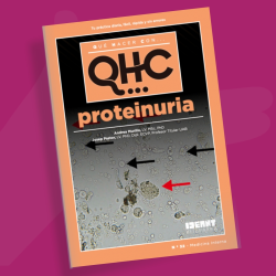 Qué Hacer Con... Proteinuria