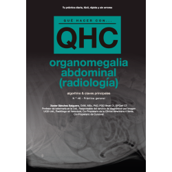 Qué Hacer Con...Organomegalia Abdominal (Radiología)