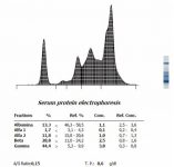 Figura 26. Proteinograma Leishmaniosis