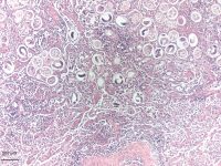 Foto 9d_Aelurostrongylus abstrusus lung tissue HE_2