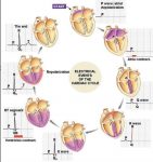 Generación de un Electrocardiograma