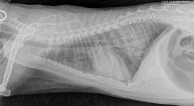 Radiografía torácica LL con edema pulmonar cardiogénico